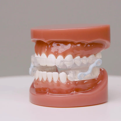 Senura Pro - Vylepšený Náustek | Maximální Pohodlí Každou Noc